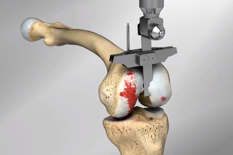 ¿Cuáles son las ventajas de usar el protocolo Signature de Zimmer